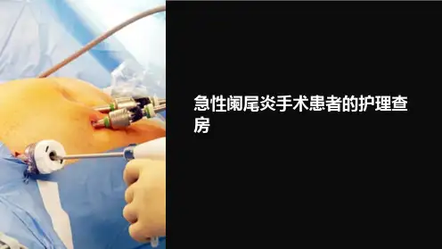 急性阑尾炎手术患者的护理查房
