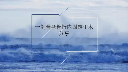 骨盆骨折手术配合 ppt