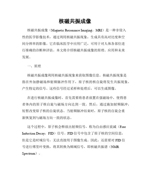 核磁共振成像