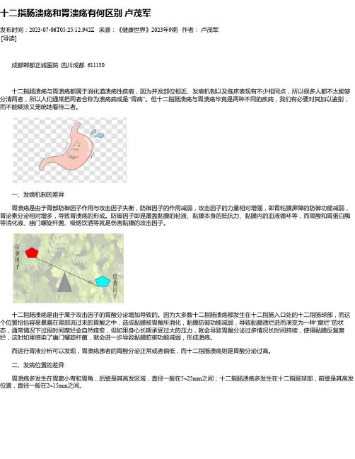 十二指肠溃疡和胃溃疡有何区别卢茂军