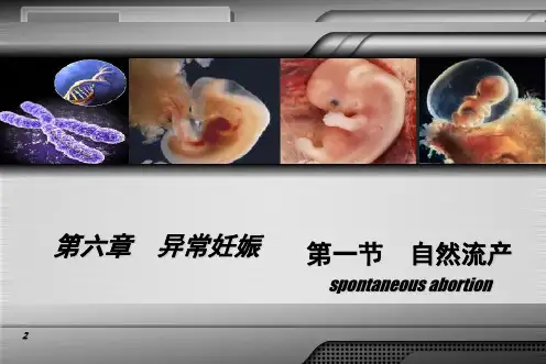 自然流产ppt课件