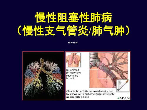 慢性阻塞性肺病科普)
