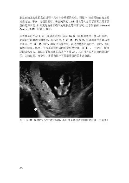 详细版北医李睿医考：正常与异常胎盘的超声表现