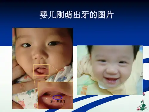 牙齿的发育过程课件PPT