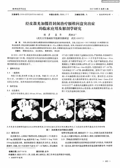 经皮激光加骶管封闭治疗腰椎间盘突出症的临床应用及解剖学研究