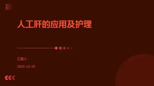 人工肝的应用及护理