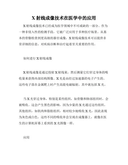 X射线成像技术在医学中的应用