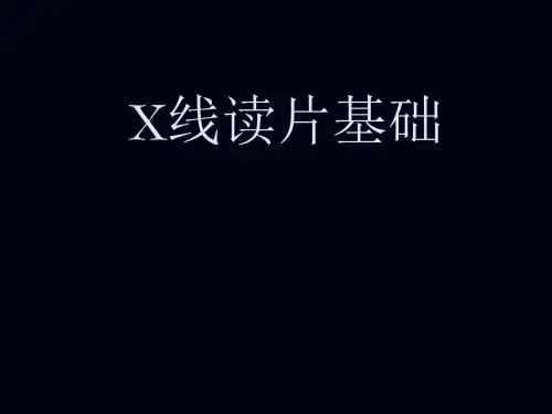 x线读片基础