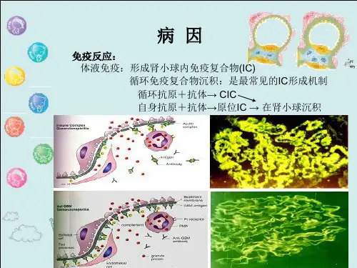 最新【医药健康】肾小球疾病--PPT文档