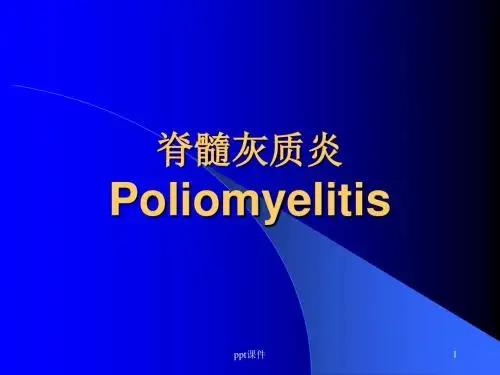脊髓灰质炎  ppt课件