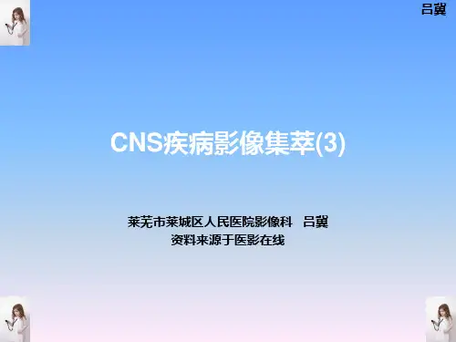 医影在线--CNS疾病影像图库(3)