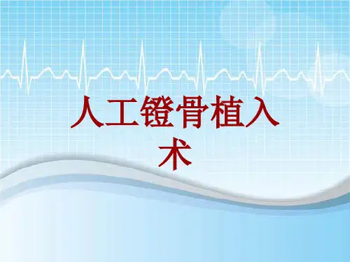 外科手术教学资料：人工镫骨植入术讲解模板