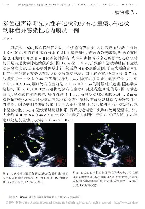 彩色超声诊断先天性右冠状动脉右心室瘘_右冠状动脉瘤并感染性心内膜炎一例