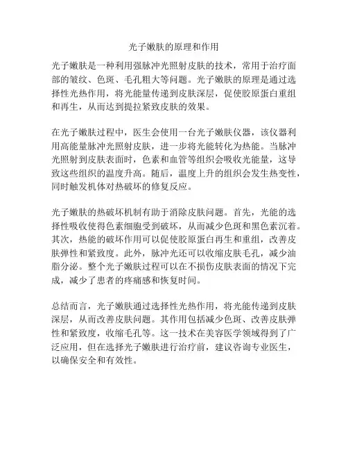 光子嫩肤的原理和作用