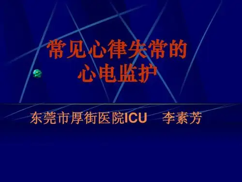 常见心律失常心电图的观察1