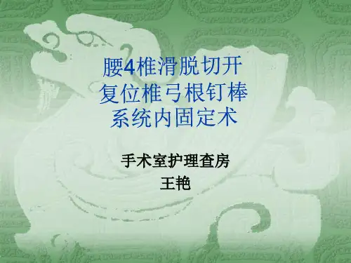 腰4椎滑脱切开复位椎弓根钉棒系统内固定术