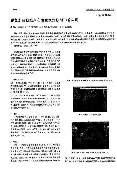 彩色多普勒超声在胎盘疾病诊断中的应用
