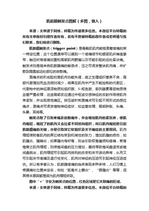 肌筋膜触发点图解（多图，慎入）