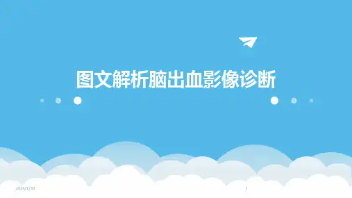 图文解析脑出血影像诊断(2024)