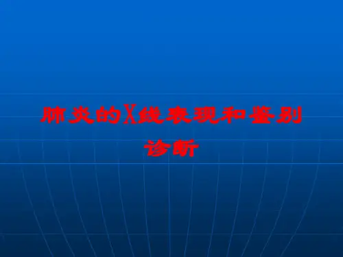 肺炎的X线表现和鉴别诊断培训课件