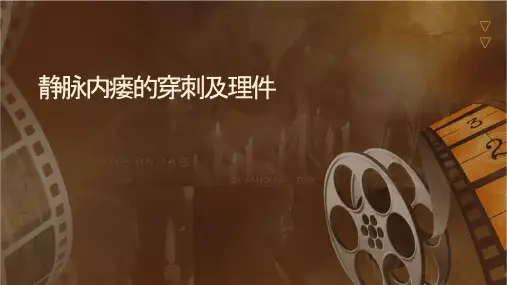 动静脉内瘘的穿刺及护理课件