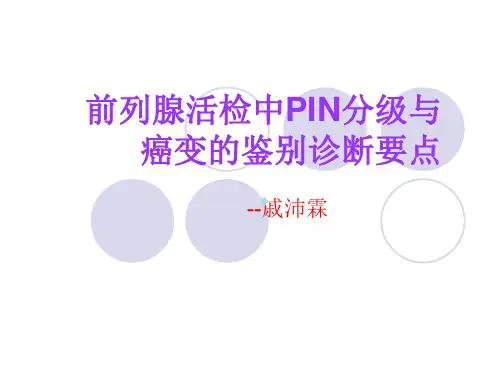 前列腺活检中PIN分级与