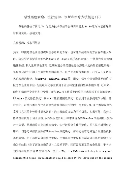 恶性黑色素瘤流行病学诊断和治疗方法概述下