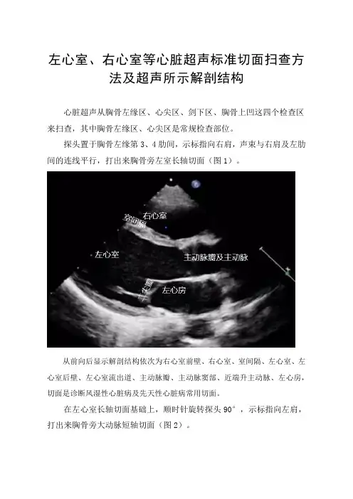 左心室、右心室等心脏超声常用标准切面扫查方法超声所示解剖结构