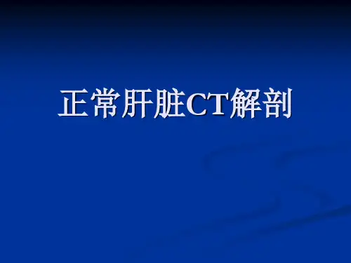 正常肝脏CT解剖