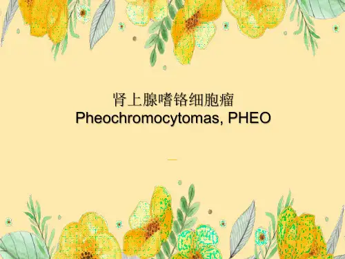 肾上腺嗜铬细胞瘤影像