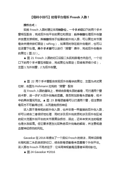 【骨科小技巧】胫骨平台骨折Frosch入路！