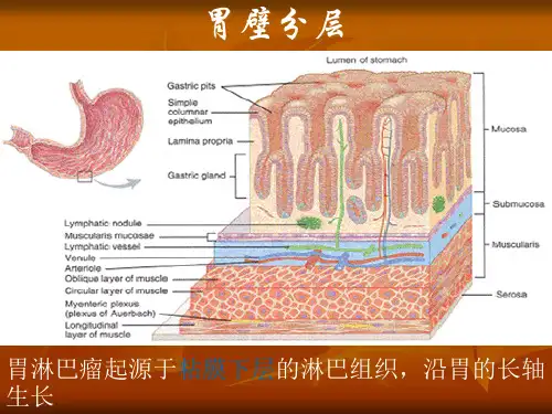 胃淋巴瘤小结(影像学速记)精品PPT课件
