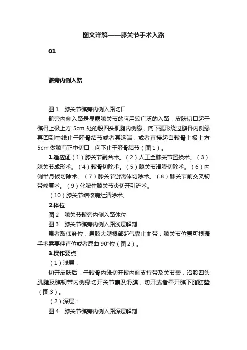 图文详解——膝关节手术入路