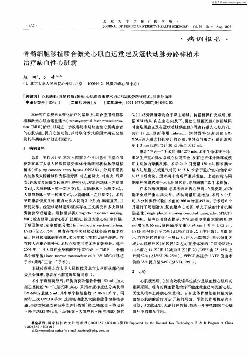 骨髓细胞移植联合激光心肌血运重建及冠状动脉旁路移植术治疗缺血性心脏病