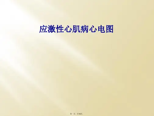 应激性心肌病心电图