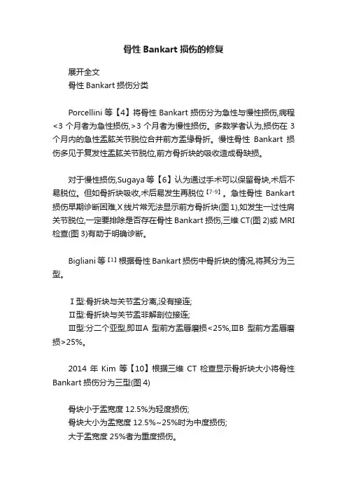 骨性Bankart损伤的修复