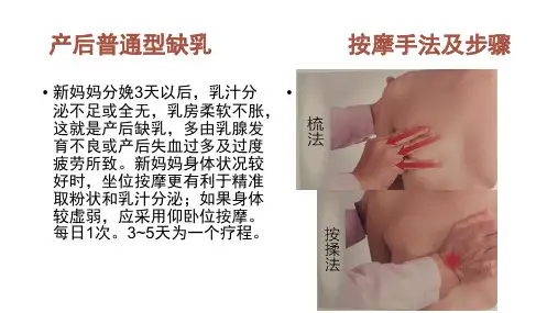 产后普通型缺乳  ppt课件