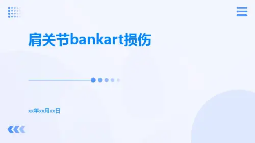(医学课件)肩关节bankart损伤