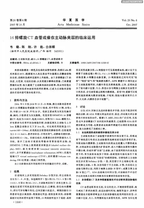 16排螺旋CT血管成像在主动脉夹层的临床运用