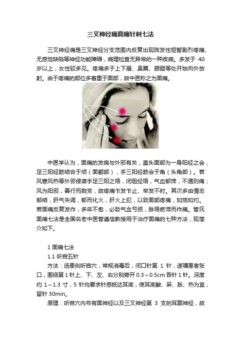 三叉神经痛面痛针刺七法