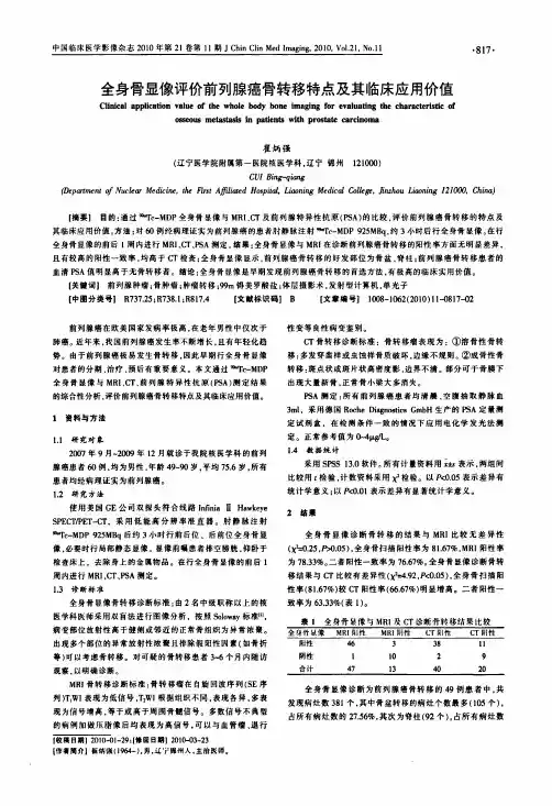 全身骨显像评价前列腺癌骨转移特点及其临床应用价值