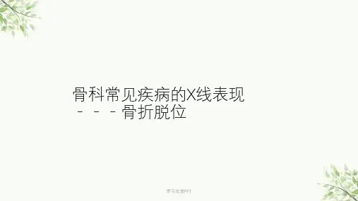 骨科X线片教学医学PPT课件