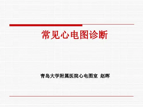 常见心电图诊断 - 技能大赛