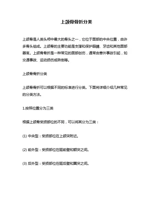 上颌骨骨折分类