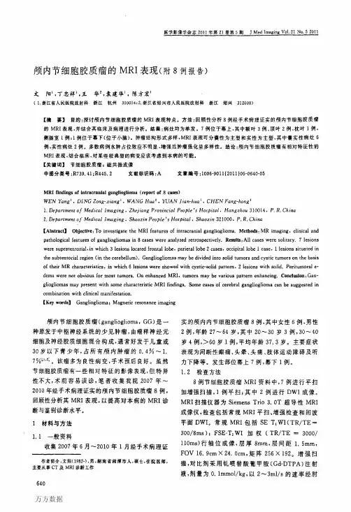 颅内节细胞胶质瘤的MRI表现(附8例报告)