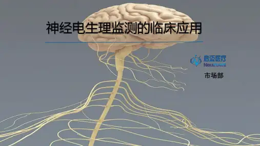 神经电生理监测的临床应用PPT参考幻灯片