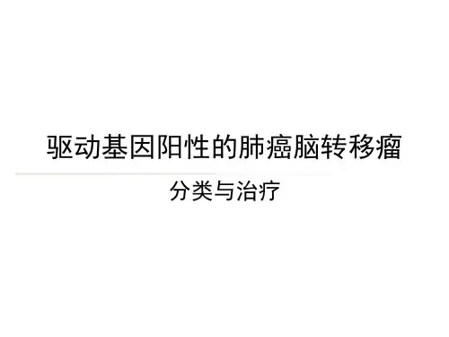 驱动基因阳性肺癌脑转移