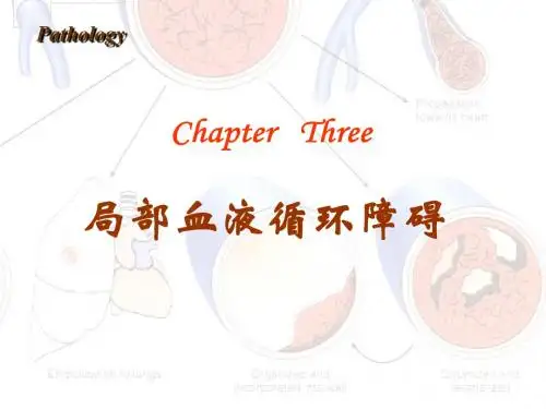 病理学(第八版)最新课件局部血液循环障碍