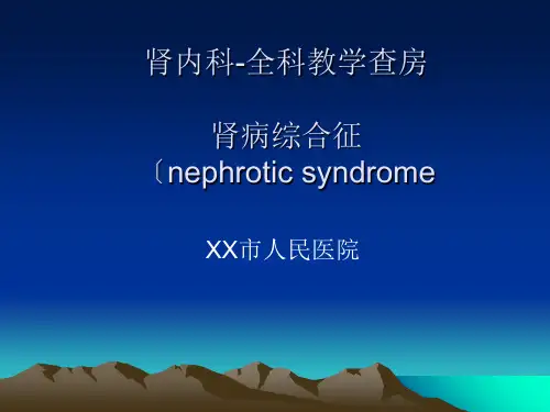教学查房范本(全科)肾病综合征
