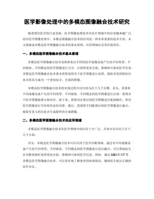 医学影像处理中的多模态图像融合技术研究